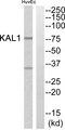 ANOS1 / Anosmin Antibody - Western blot analysis of extracts from HuvEc cells, using KAL1 antibody.