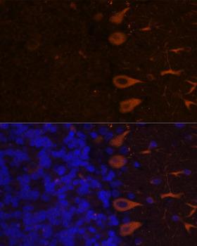 ANOS1 / Anosmin Antibody - Immunofluorescence analysis of Rat brain using KAL1 Polyclonal Antibody at dilution of 1:100.Blue: DAPI for nuclear staining.