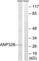 ANP32B Antibody - Western blot analysis of lysates from rat brain cells, using ANP32B Antibody. The lane on the right is blocked with the synthesized peptide.