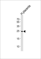 ANP32B Antibody - Western blot of lysate from human placenta tissue lysate, using ANP32B Antibody. Antibody was diluted at 1:1000 at each lane. A goat anti-rabbit IgG H&L (HRP) at 1:5000 dilution was used as the secondary antibody. Lysate at 35ug per lane.