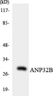 ANP32B Antibody - Western blot analysis of the lysates from HeLa cells using ANP32B antibody.