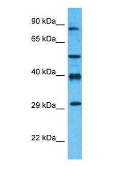 ANP32B Antibody - Western blot of AN32B Antibody with human MCF7 Whole Cell lysate.  This image was taken for the unconjugated form of this product. Other forms have not been tested.