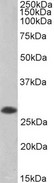 ANP32B Antibody - Biotinylated antibody (0.2µg/ml) staining of Human Tonsil lysate (35µg protein in RIPA buffer), exactly mirroring its parental non-biotinylated product. Primary incubation was 1 hour. Detected by chemiluminescence, using streptavidin-HRP and using NAP bloc