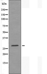 ANP32B Antibody - Western blot analysis of extracts of rat brain cells using ANP32B antibody.