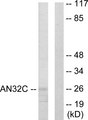 ANP32C Antibody - Western blot analysis of lysates from HUVEC cells, using ANP32C Antibody. The lane on the right is blocked with the synthesized peptide.