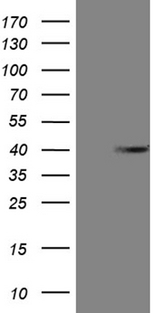 ANP32C Antibody - HEK293T cells were transfected with the pCMV6-ENTRY control. (Left lane) or pCMV6-ENTRY ANP32C. (Right lane) cDNA for 48 hrs and lysed. Equivalent amounts of cell lysates. (5 ug per lane) were separated by SDS-PAGE and immunoblotted with anti-ANP32C. (1:2000)
