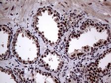 ANP32C Antibody - Immunohistochemical staining of paraffin-embedded Human prostate tissue within the normal limits using anti-ANP32C mouse monoclonal antibody. (Heat-induced epitope retrieval by 1mM EDTA in 10mM Tris buffer. (pH8.5) at 120°C for 3 min. (1:2000)