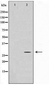 ANP32C Antibody - Western blot of HUVEC cell lysate using ANP32C Antibody