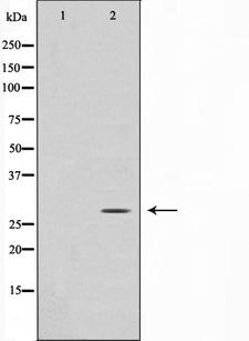 ANP32C Antibody - Western blot analysis on HuvEc cell lysates using ANP32C antibody. The lane on the left is treated with the antigen-specific peptide.