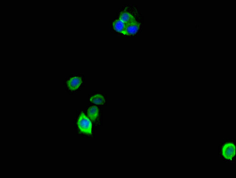 ANP32D Antibody - Immunofluorescent analysis of Hela cells using ANP32D Antibody at a dilution of 1:100 and Alexa Fluor 488-congugated AffiniPure Goat Anti-Rabbit IgG(H+L)