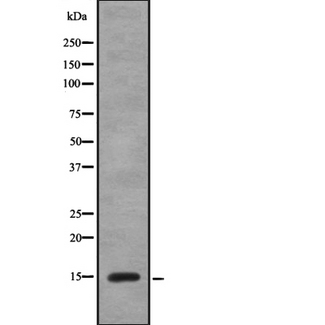 ANP32D Antibody - Western blot analysis of ANP32D using COLO205 whole cells lysates