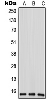 ANP32D Antibody - Western blot analysis of ANP32D expression in HeLa (A); mouse liver (B); rat liver (C) whole cell lysates.