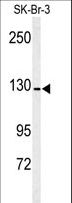 ANPEP / CD13 Antibody - Western blot of ANPEP antibody in SK-Br-3 cell line lysates (35 ug/lane). ANPEP (arrow) was detected using the purified antibody.