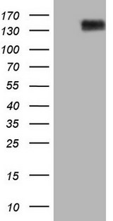 ANPEP / CD13 Antibody - HEK293T cells were transfected with the pCMV6-ENTRY control. (Left lane) or pCMV6-ENTRY ANPEP. (Right lane) cDNA for 48 hrs and lysed. Equivalent amounts of cell lysates. (5 ug per lane) were separated by SDS-PAGE and immunoblotted with anti-ANPEP. (1:2000)