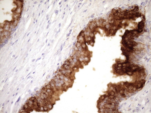 ANPEP / CD13 Antibody - Immunohistochemical staining of paraffin-embedded Human prostate tissue within the normal limits using anti-ANPEP mouse monoclonal antibody. (Heat-induced epitope retrieval by Tris-EDTA, pH8.0)(1:150)