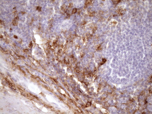 ANPEP / CD13 Antibody - Immunohistochemical staining of paraffin-embedded Human tonsil within the normal limits using anti-ANPEP mouse monoclonal antibody. (Heat-induced epitope retrieval by Tris-EDTA, pH8.0)(1:150)