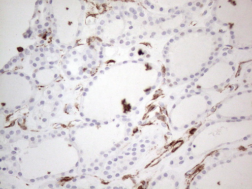 ANPEP / CD13 Antibody - Immunohistochemical staining of paraffin-embedded Human thyroid tissue within the normal limits using anti-ANPEP mouse monoclonal antibody. (Heat-induced epitope retrieval by 1mM EDTA in 10mM Tris buffer. (pH8.5) at 120°C for 3 min. (1:150)