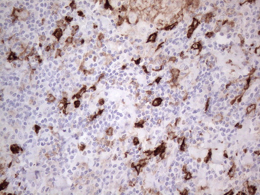 ANPEP / CD13 Antibody - Immunohistochemical staining of paraffin-embedded Human lymph node tissue within the normal limits using anti-ANPEP mouse monoclonal antibody. (Heat-induced epitope retrieval by 1mM EDTA in 10mM Tris buffer. (pH8.5) at 120°C for 3 min. (1:150)