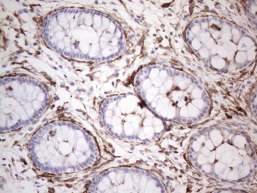 ANPEP / CD13 Antibody - Immunohistochemical staining of paraffin-embedded Human colon tissue within the normal limits using anti-ANPEP mouse monoclonal antibody. (Heat-induced epitope retrieval by 1mM EDTA in 10mM Tris buffer. (pH8.5) at 120°C for 3 min. (1:150)