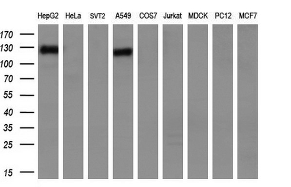ANPEP / CD13 Antibody - Western blot analysis of extracts. (35ug) from 9 different cell lines by using anti-ANPEP monoclonal antibody. (HepG2: human; HeLa: human; SVT2: mouse; A549: human; COS7: monkey; Jurkat: human; MDCK: canine;rat; MCF7: human). (1:200)