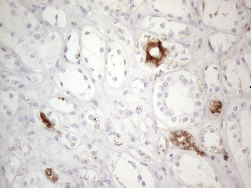 ANPEP / CD13 Antibody - Immunohistochemical staining of paraffin-embedded Human Kidney tissue within the normal limits using anti-ANPEP mouse monoclonal antibody. (Heat-induced epitope retrieval by 1mM EDTA in 10mM Tris buffer. (pH8.5) at 120°C for 3 min. (1:150)