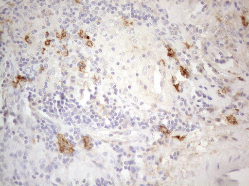 ANPEP / CD13 Antibody - Immunohistochemical staining of paraffin-embedded Human lymph node tissue using anti-ANPEP mouse monoclonal antibody. (Heat-induced epitope retrieval by 1mM EDTA in 10mM Tris buffer. (pH8.5) at 120°C for 3 min. (1:150)