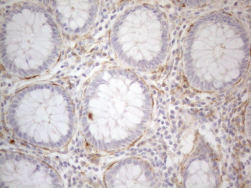 ANPEP / CD13 Antibody - Immunohistochemical staining of paraffin-embedded Human colon tissue using anti-ANPEP mouse monoclonal antibody. (Heat-induced epitope retrieval by 1mM EDTA in 10mM Tris buffer. (pH8.5) at 120°C for 3 min. (1:150)