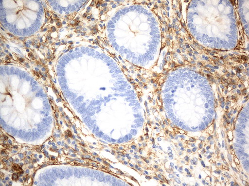 ANPEP / CD13 Antibody - Immunohistochemical staining of paraffin-embedded Human appendix tissue within the normal limits using anti-CD13 mouse monoclonal antibody. (Heat-induced epitope retrieval by 1mM EDTA in 10mM Tris buffer. (pH8.0) at 120°C for 2.5 min. (1:1000)