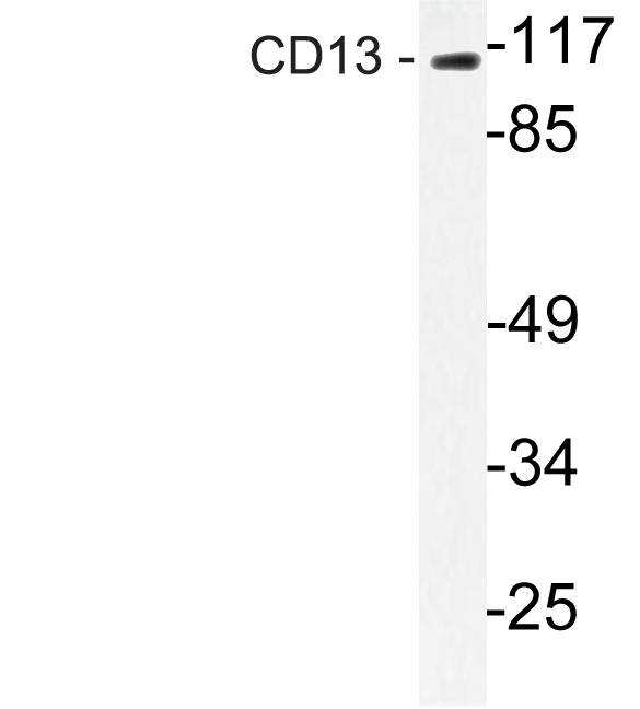 ANPEP / CD13 Antibody - Western blot analysis of lysate from mouse liver, using CD13 antibody.