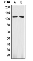 ANPEP / CD13 Antibody - Western blot analysis of CD13 expression in A375 (A); THP1 (B) whole cell lysates.