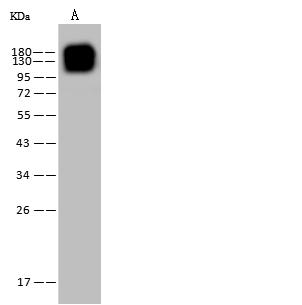 ANPEP / CD13 Antibody - Anti-ANPEP mouse monoclonal antibody at 1:500 dilution. Lane A: THP-1 Whole Cell Lysate. Lysates/proteins at 30 ug per lane. Secondary: Goat Anti-Mouse IgG (H+L)/HRP at 1/10000 dilution. Developed using the ECL technique. Performed under reducing conditions. Predicted band size: 110 kDa. Observed band size: 140 kDa.