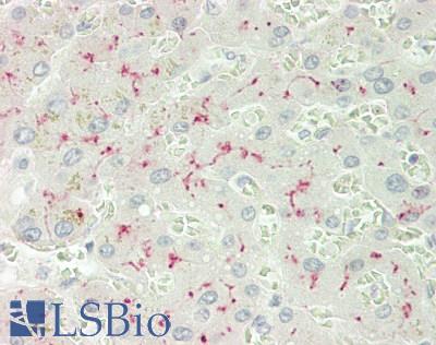 ANPEP / CD13 Antibody - Human Liver: Formalin-Fixed, Paraffin-Embedded (FFPE)