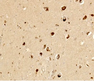 ANPEP / CD13 Antibody - IHC testing of FFPE human brain with CD13 antibody (clone WM15). This image was taken for the unmodified form of this product. Other forms have not been tested.