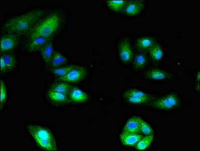 ANPEP / CD13 Antibody - Immunofluorescent analysis of HepG2 cells diluted at 1:100 and Alexa Fluor 488-congugated AffiniPure Goat Anti-Rabbit IgG(H+L)