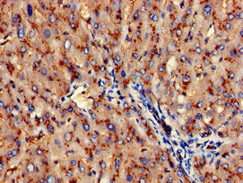 ANPEP / CD13 Antibody - Immunohistochemistry of paraffin-embedded human liver tissue at dilution of 1:100