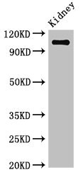 ANPEP / CD13 Antibody - Western Blot Positive WB detected in:Mouse kidney tissue All Lanes:ANPEP antibody at 3.4µg/ml Secondary Goat polyclonal to rabbit IgG at 1/50000 dilution Predicted band size: 110 KDa Observed band size: 110 KDa