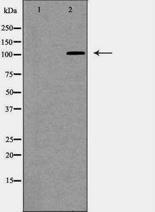ANPEP / CD13 Antibody - Western blot analysis of HepG2 whole cells lysates using ANPEP antibody. The lane on the left is treated with the antigen-specific peptide.