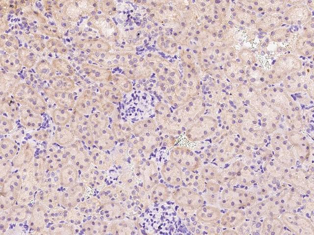 ANPEP / CD13 Antibody - Immunochemical staining of rat ANPEP in rat kidney with rabbit polyclonal antibody at 1:300 dilution, formalin-fixed paraffin embedded sections.