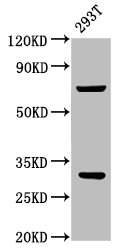 ANT2 / SLC25A5 Antibody - Western Blot Positive WB detected in:293T whole cell lysate All Lanes:SLC25A5 antibody at 3.5µg/ml Secondary Goat polyclonal to rabbit IgG at 1/50000 dilution Predicted band size: 33 KDa Observed band size: 33 KDa