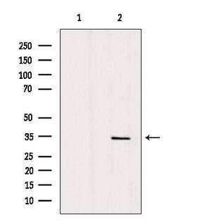 ANT2 / SLC25A5 Antibody - Western blot analysis of extracts of mouse brain tissue using SLC25A5 antibody. Lane 1 was treated with the blocking peptide.