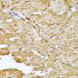 ANT2 / SLC25A5 Antibody - Immunohistochemistry of paraffin-embedded Rat heart using SLC25A5 Polyclonal Antibody at dilution of 1:100 (40x lens).