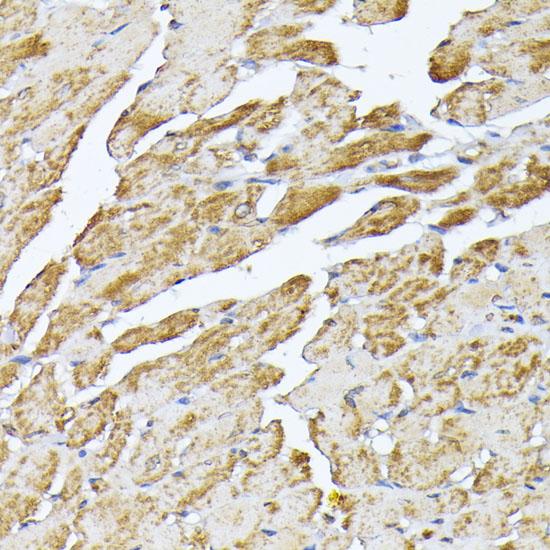 ANT2 / SLC25A5 Antibody - Immunohistochemistry of paraffin-embedded Mouse heart using SLC25A5 Polyclonal Antibody at dilution of 1:100 (40x lens).