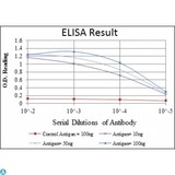 Anti-ANIB1 antibody Antibody - Western Blot (WB) analysis using ANIB1 Monoclonal Antibody against T47D (1) and MCF-7 (2) cell lysate.