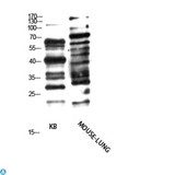 Anti Pan- myristoylation Antibody Antibody - Western Blot (WB) analysis of KB, Mouse Lung cells using Antibody diluted at 1:1000.