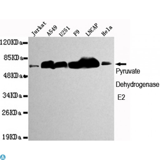 Anti-Pyruvate Dehydrogenase E2 antibody Antibody - Western blot detection of Pyruvate Dehydrogenase E2 in Jurkat, A549, U251, F9, Lncap and Hela cell lysates using Pyruvate Dehydrogenase E2 mouse mAb (1:1000 diluted). Predicted band size: 69KDa. Observed band size: 69KDa.