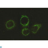 Anti-Pyruvate Dehydrogenase E2 antibody Antibody - Immunocytochemistry stain of Hela using Pyruvate Dehydrogenase E2 mouse mAb (1:300).
