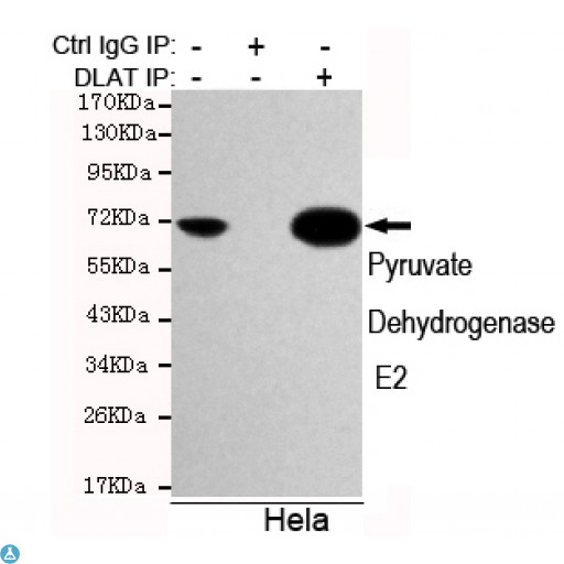 Anti-Pyruvate Dehydrogenase E2 antibody Antibody - Immunoprecipitation analysis of Hela cell lysates using Pyruvate Dehydrogenase E2 mouse mAb.