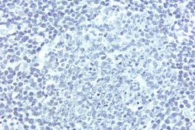 Product - Lymph Node: Without pH 9.0 Antigen Unmasking Solution, Cyclin D1 (rm), ImmPRESS™ Anti-Rabbit Ig Kit, DAB (brown) substrate. Hematoxylin QS (blue) counterstain.