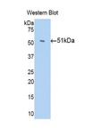 Antithrombin Antibody - Western blot of recombinant SERPINC1 / Antithrombin III.  This image was taken for the unconjugated form of this product. Other forms have not been tested.