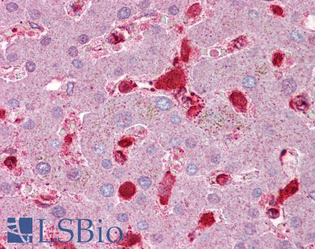 Antithrombin-III Antibody - Anti-Antithrombin III antibody IHC of human liver. Immunohistochemistry of formalin-fixed, paraffin-embedded tissue after heat-induced antigen retrieval. Antibody concentration 5 ug/ml.  This image was taken for the unconjugated form of this product. Other forms have not been tested.